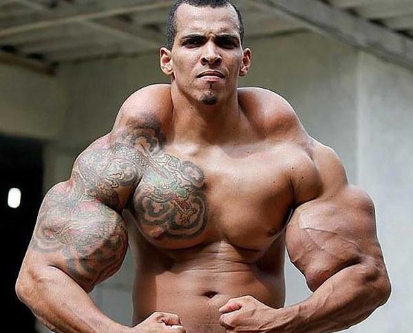 El “Hulk humano” debió cambiar su cuerpo para evitar que le amputaran los brazos